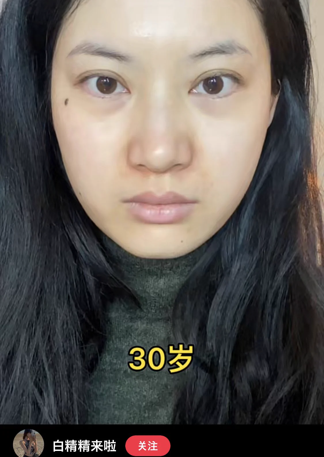 中国のT^Vコンシーラー法！30歳が20歳の見た目になれる！