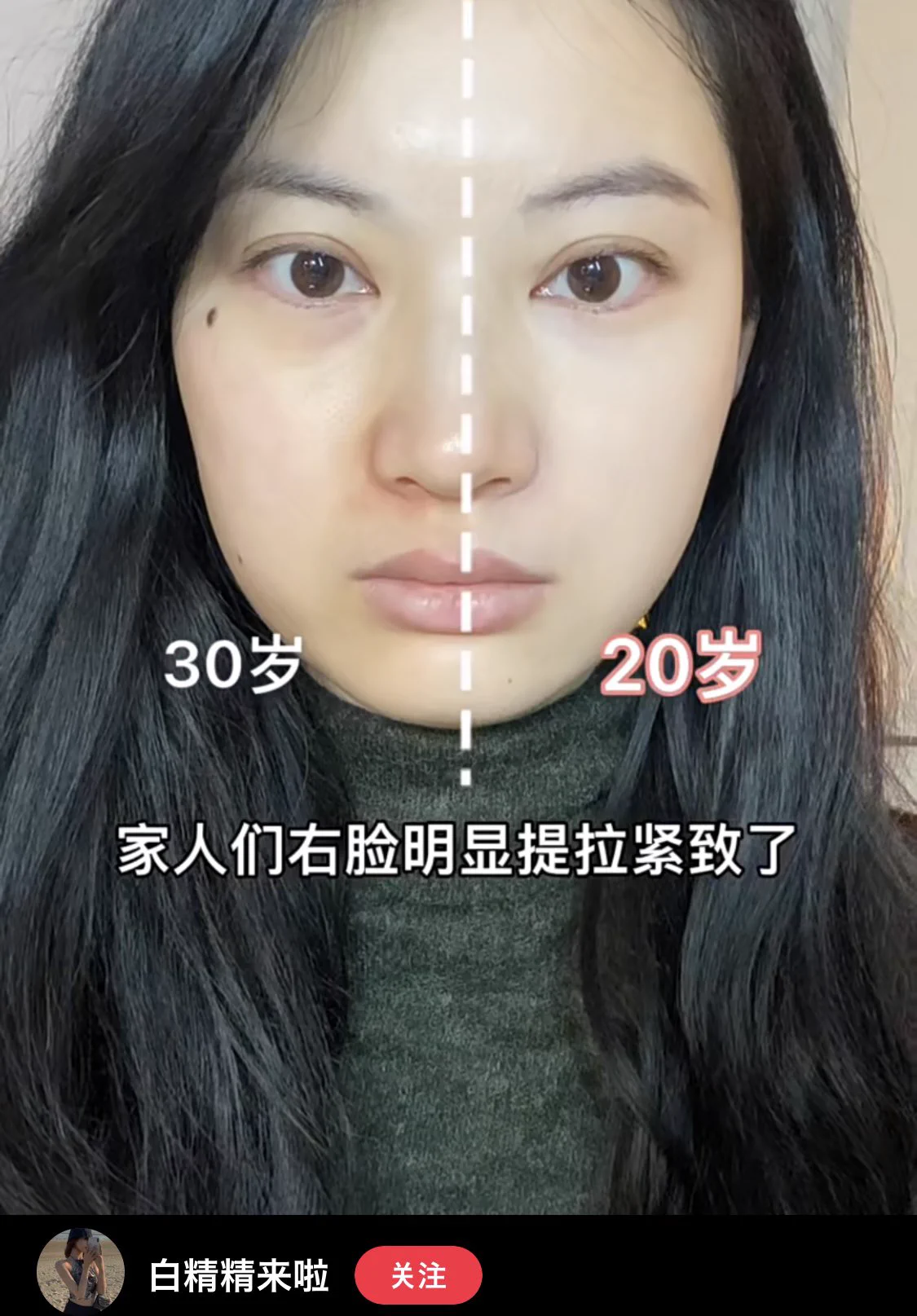 中国のT^Vコンシーラー法！30歳が20歳の見た目になれる！