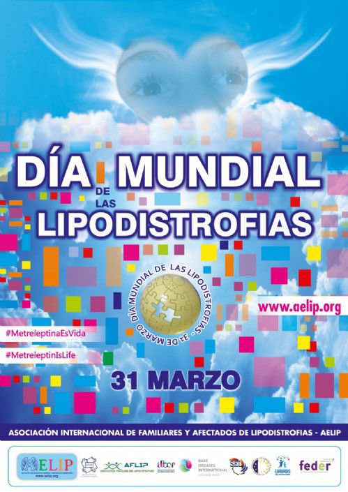xcaballerogo's tweet photo. Hoy con nuestro apoyo, queremos dar visibilidad a la #Lipodistrofia en su día mundial. Esta patología se caracteriza por la ausencia focal o general de tejido adiposo, su etiología es múltiple y sus manifestaciones clínicas diversas. @AELIP_ #MetreleptinaEsVida #EERR https://t.co/R3FRN9GLAy