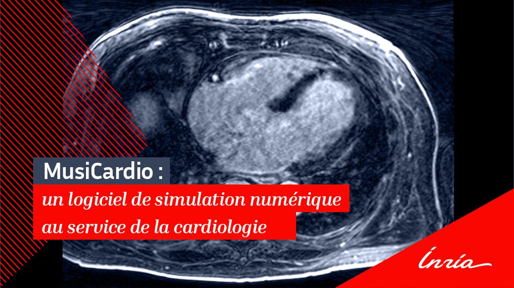 Inria_Bordeaux's tweet image. 🧐 Partez aujourd’hui à la découverte du #logiciel MusiCardio développé par @Inria et l’@ihu_liryc consacré à la cardiologie. Retour sur un projet pluridisciplinaire mêlant #mathématiques, simulations #numériques et #cardiologie.

👉 bit.ly/3NA8Cuc