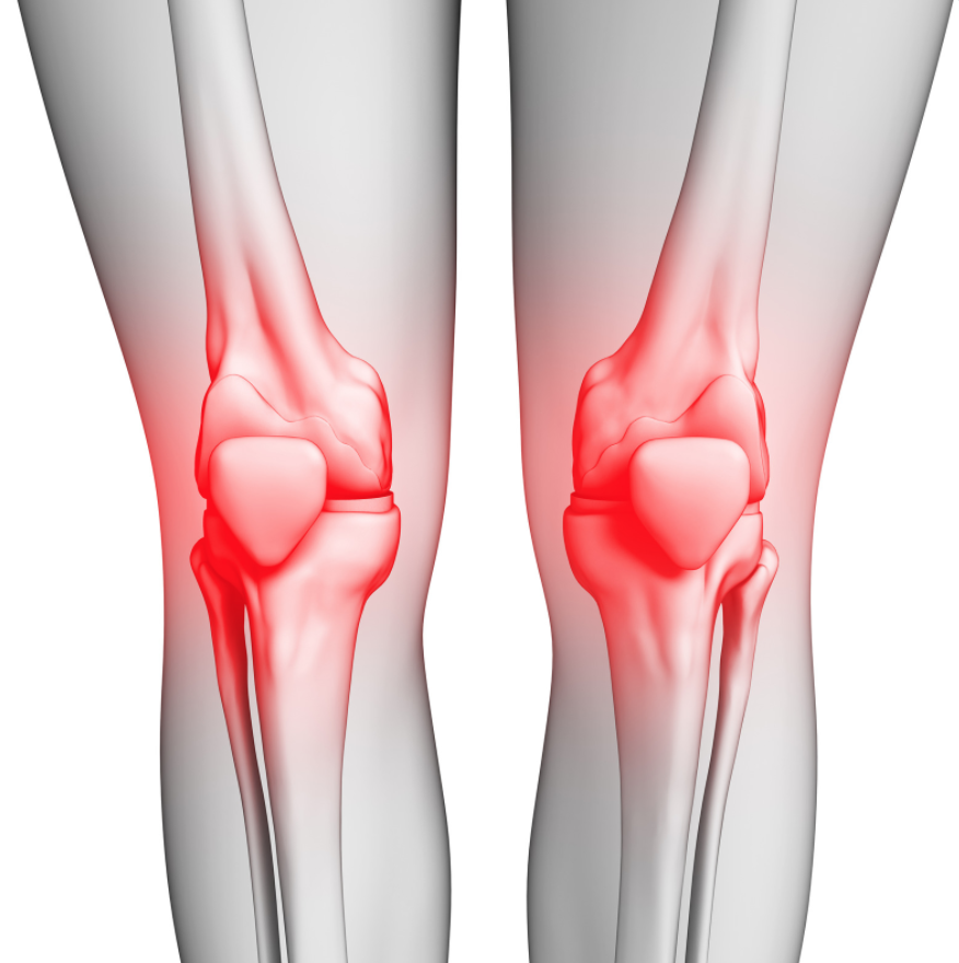 thekneedoc's tweet photo. What medicines may be useful to treat a #peroneal #nervepalsy?
If this occurs due to a trauma, such as a sporting instrument hitting the outside of the leg, or after surgery where retraction or stretching the nerve may have inadvertently occurred...https://t.co/U2jQtTwF83 https://t.co/TAlxv43ffL