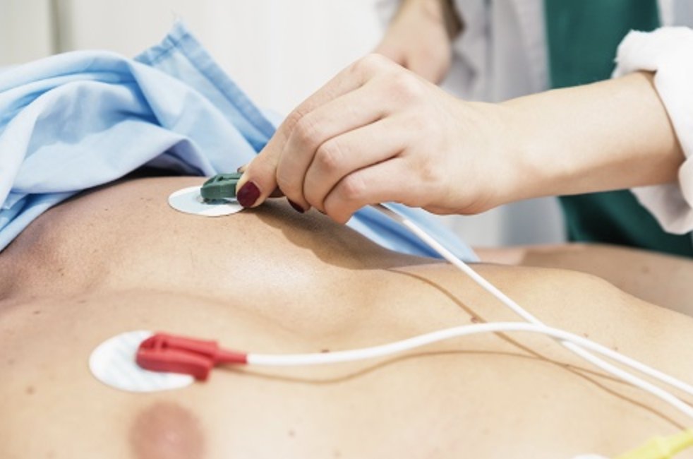 shageela_k's tweet photo. (1/15)
CALLING ALL MEDICAL STUDENTS!
Struggling to correctly place electrodes when performing a 12-lead ECG?
Look no further! This simple #tweetorial will give you a step by step guide to perfect your ECG electrode placement.
@MedicsAcademy
#MedTwitter #ECG #MedEd #sdocs https://t.co/gTb2NoUfhi