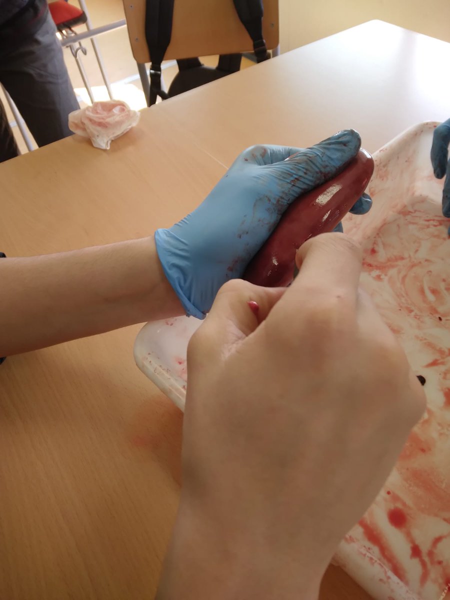 ie_martamata's tweet photo. Durant el projecte Dona Sang, els alumnes de 3r d'ESO han estat treballant la relació dels diferents sistemes del cos amb la sang. Per grups, han buscat informació d'un dels sistemes i s'han preparat per explicar-ho als seus companys tant a nivell teòric com pràctic. #SecIEMM https://t.co/aErKQJl5Wj