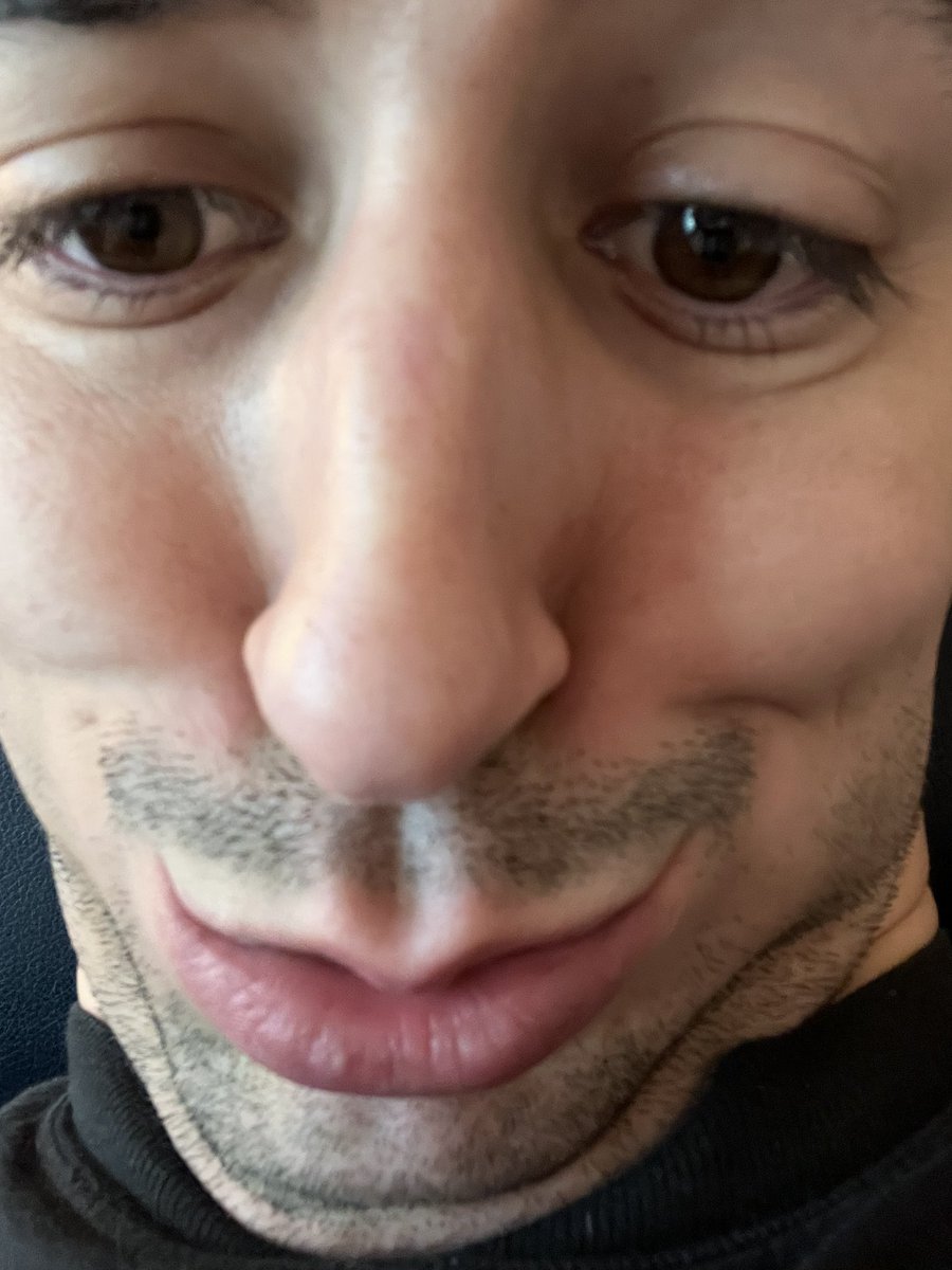 AlfredoPlays's tweet photo. Bro... https://t.co/8YSsroqMEt