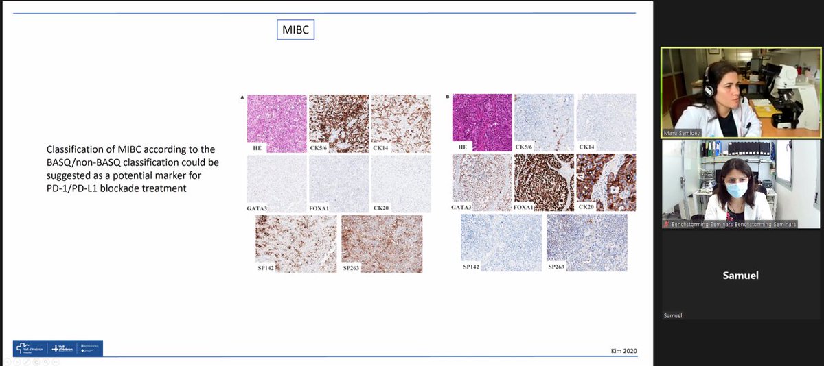 VHIO's tweet photo. Great Clinical Benchstorming Seminar with Dr. Maria Eugenia Semidey Raven (@msemideyr), Pathologist specialized in Genitourinary pahology. https://t.co/fL6akiCdLL