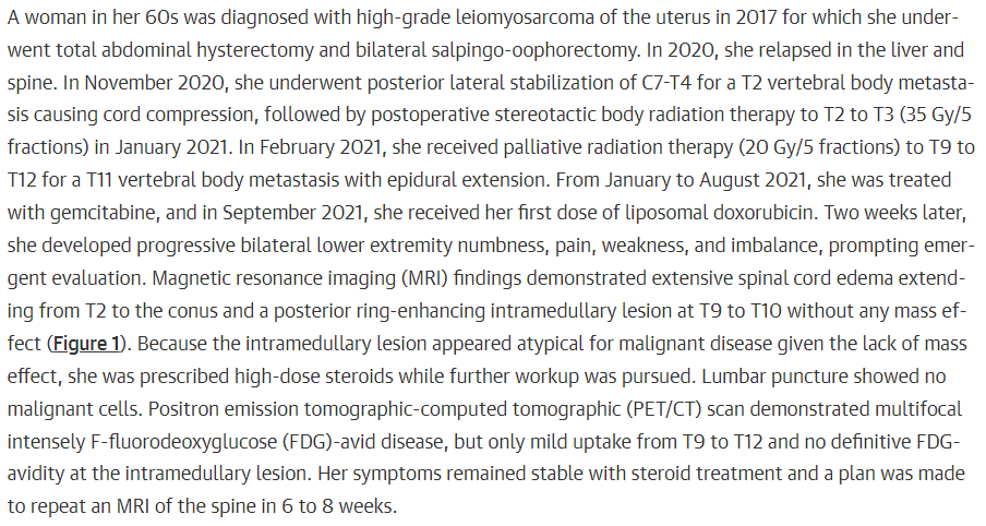 BrighamRadOnc's tweet photo. 📰Check out this fascinating report on a case of radiation recall myelopathy by @NayanLamba and @DBittermanMD in @JAMAOnc: 🔗https://t.co/KAdobTQBDm
#radiationrecall #radiationtoxicity #BWHRadOnc #JAMAOncology https://t.co/Tw0gtcAB4o