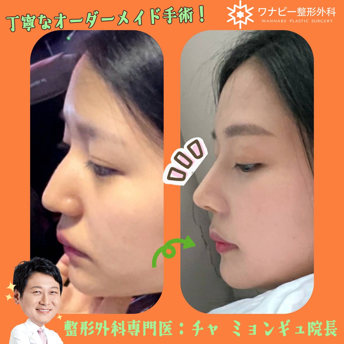 だんご鼻 のtwitterリアルタイム検索結果 Meyou ミーユー