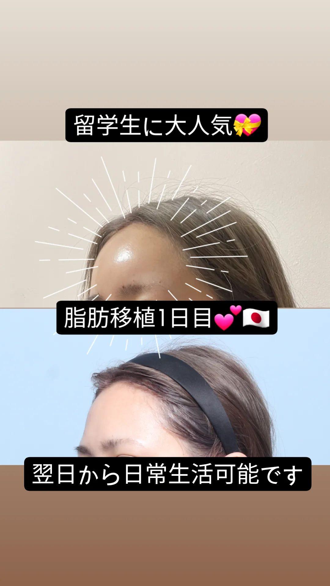 ツヤ肌 Twitter Search Twitter