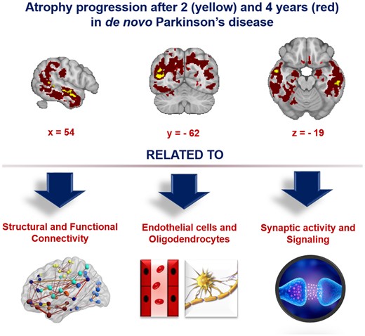 braincomms's tweet photo. Tremblay et al. report a specific pattern of atrophy progression over four years in the brain of patients with de novo Parkinson’s disease. https://t.co/snEnJ3p7FH @Christina3mblay @FilipKMorys @alain_dagher @ndrewvo @Shrahay @ZivGanOr @misicbata @goliashf @rossdavism https://t.co/N0FbTADXzk