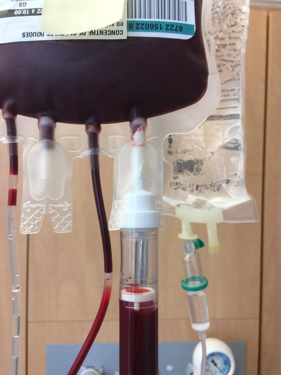 skyper93's tweet photo. C’est partie pour ma transfusion de sang. Ma chimio par comprimés, le Zytiga, a été suspendue car on la soupçonne d’abîmer mon foie. Je suis toujours à l’hôpital pour étudier le fond de ma santé. Après 9 mois d’abandon, c’est enfin rassurant d’être pris au sérieux. 🙏😃✊ https://t.co/BMl5ux8u7t