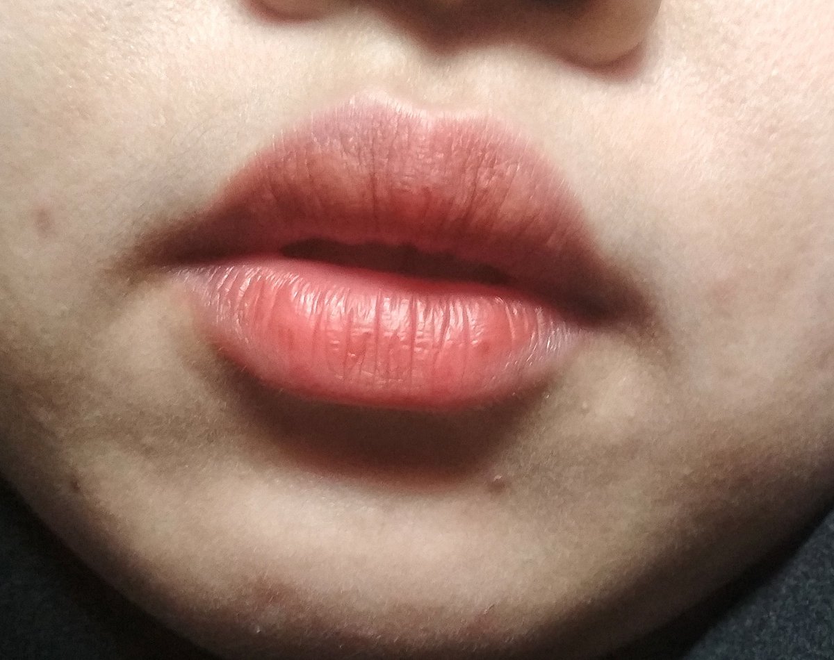 akungalaoo's tweet photo. #GlowUpdate
Lip tint ini somehow enak juga buat dipake daily, warnanya ga terlalu strong tapi bikin ✨warm up✨ muka yg butek cape 24/7, stain dan ketahanannya oke, ga banyak transfer, dan less drying. Fav part: cuma butuh setitik udah bisa cover full lips!👍🥲
#racuninmakeup https://t.co/PeYDtNeHEt