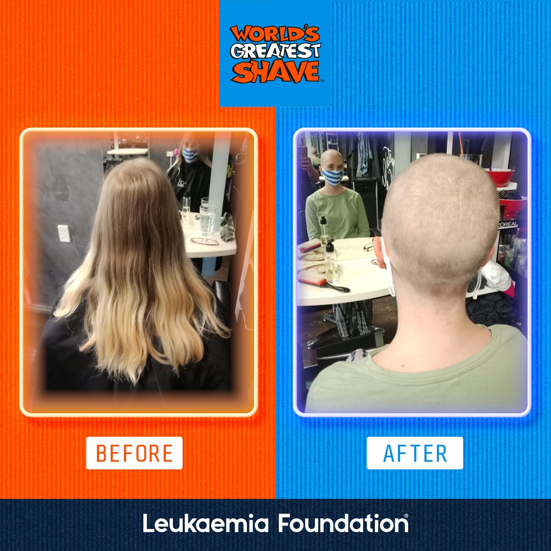It's happened! The big day has finally arrived, the shave has been done and I feel really good for it❤️
I want to give a huge thank you to the wonderful team at Snippets of Colour for sponsoring the shave today too! #worldsgreatestshave