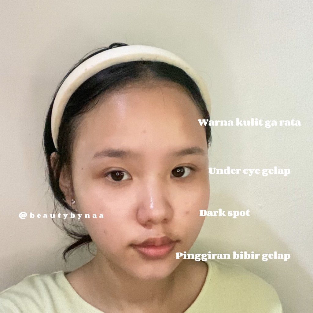 naa🧚🏻‍♀️ tweet media