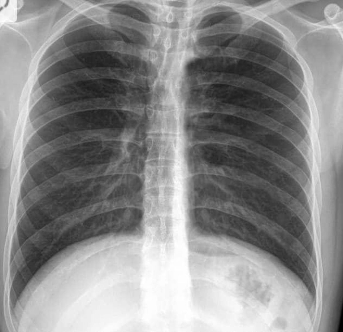 How Much Is A Chest X Ray For A Dog