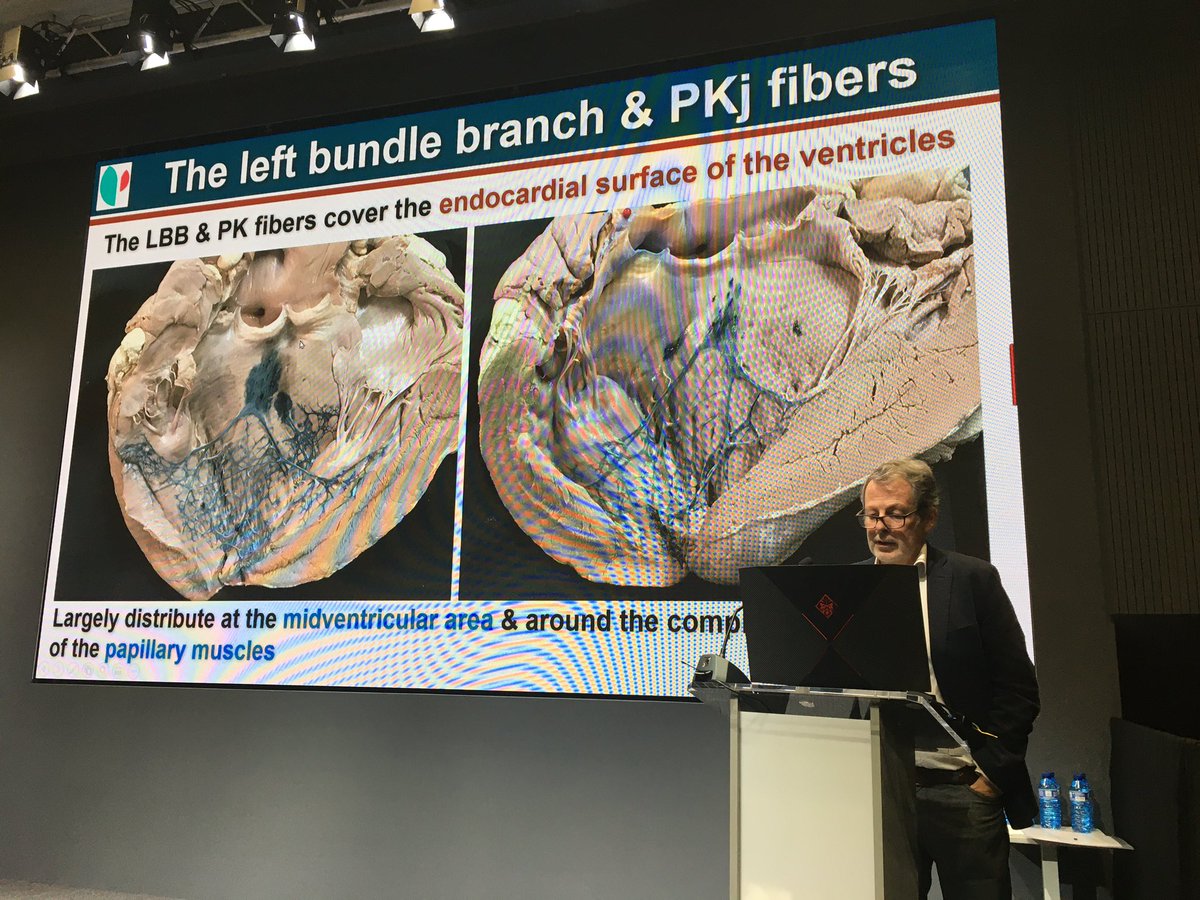 Óscar Cano (@ocanoperez) on Twitter photo Curso Nuevas formas de estimulación cardiaca: de la estimulación del sistema de conducción a la estimulación sin cables en <a href="/secardiologia/">Soc Esp Cardiología</a> @estimcardiaca <a href="/blogarritmias/">Blog Arritmias ARC</a> Un lujo contar con expertos como <a href="/jacabreracardio/">Dr. José Ángel Cabrera</a> <a href="/ManoloMolina8/">Manuel Molina-Lerma</a> <a href="/tolosanaviu/">Jose Maria tolosana</a> <a href="/icarhos/">Juan G. Martinez</a> y muchos otros! Curso Nuevas formas de estimulación cardiaca: de la estimulación del sistema de conducción a la estimulación sin cables en <a href="/secardiologia/">Soc Esp Cardiología</a> @estimcardiaca <a href="/blogarritmias/">Blog Arritmias ARC</a> Un lujo contar con expertos como <a href="/jacabreracardio/">Dr. José Ángel Cabrera</a> <a href="/ManoloMolina8/">Manuel Molina-Lerma</a> <a href="/tolosanaviu/">Jose Maria tolosana</a> <a href="/icarhos/">Juan G. Martinez</a> y muchos otros!
