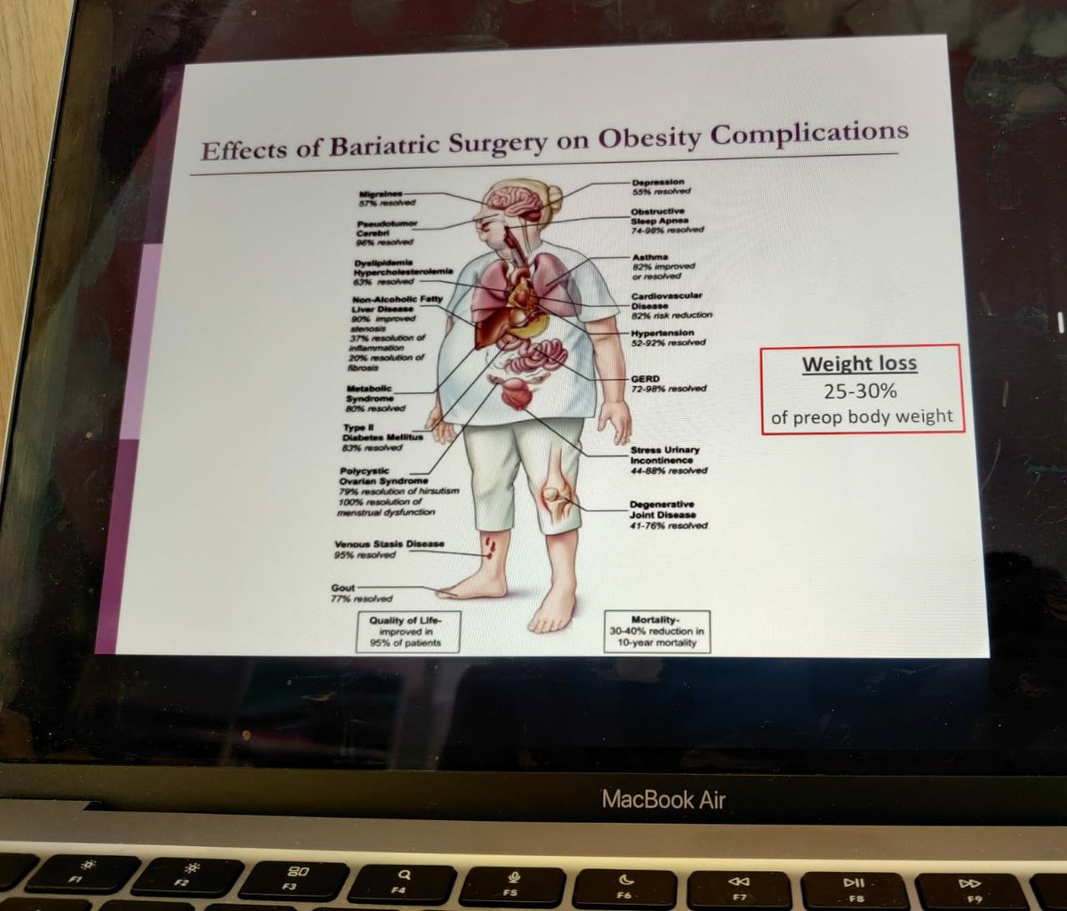 Comprehensive overview of Bariatric Surgery benefits and the fact that they go far beyond weight loss with Surgical Consultant @HeneghanHelen at #GPtraineeconf22 @ICGPnews