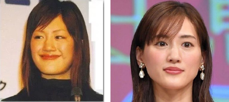 tsukino_bi's tweet photo. 整形疑惑のあがってる芸能人を見ると、実際にメスを入れた人もたくさんいるんだろうけど、いったい何kg体重を落としたのか本当に気になる
売れてる芸能人はとんでもなくカリカリ https://t.co/1Ag8LotRii