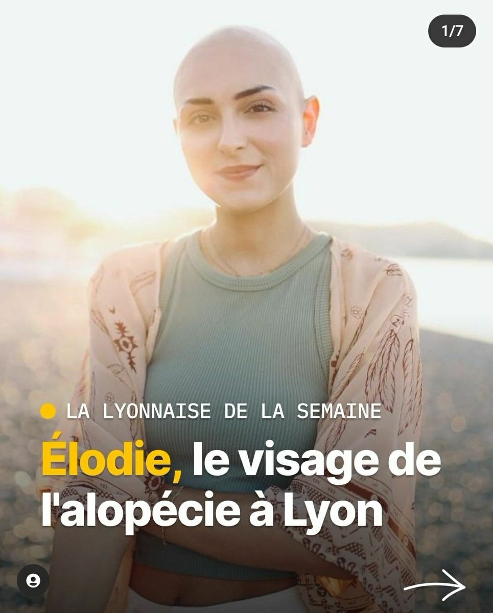LauretteDrnl's tweet photo. Aujourd'hui sur Asapp, je vous parle d'alopécie, de perte de cheveux en général, d'acceptation et de confiance en soi avec deux Lyonnaises hyper inspirantes ⤵️ https://t.co/pFtxzxLGGw