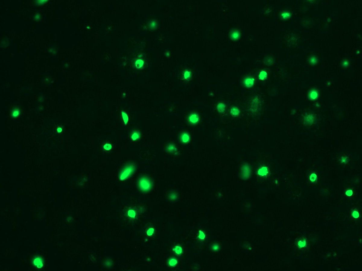 So it turns out that the NF54 line I have been working on for most of my research career is virtually impossible to transfect. We got another line and 2.5 weeks after transfection we get this. Tears of joy...