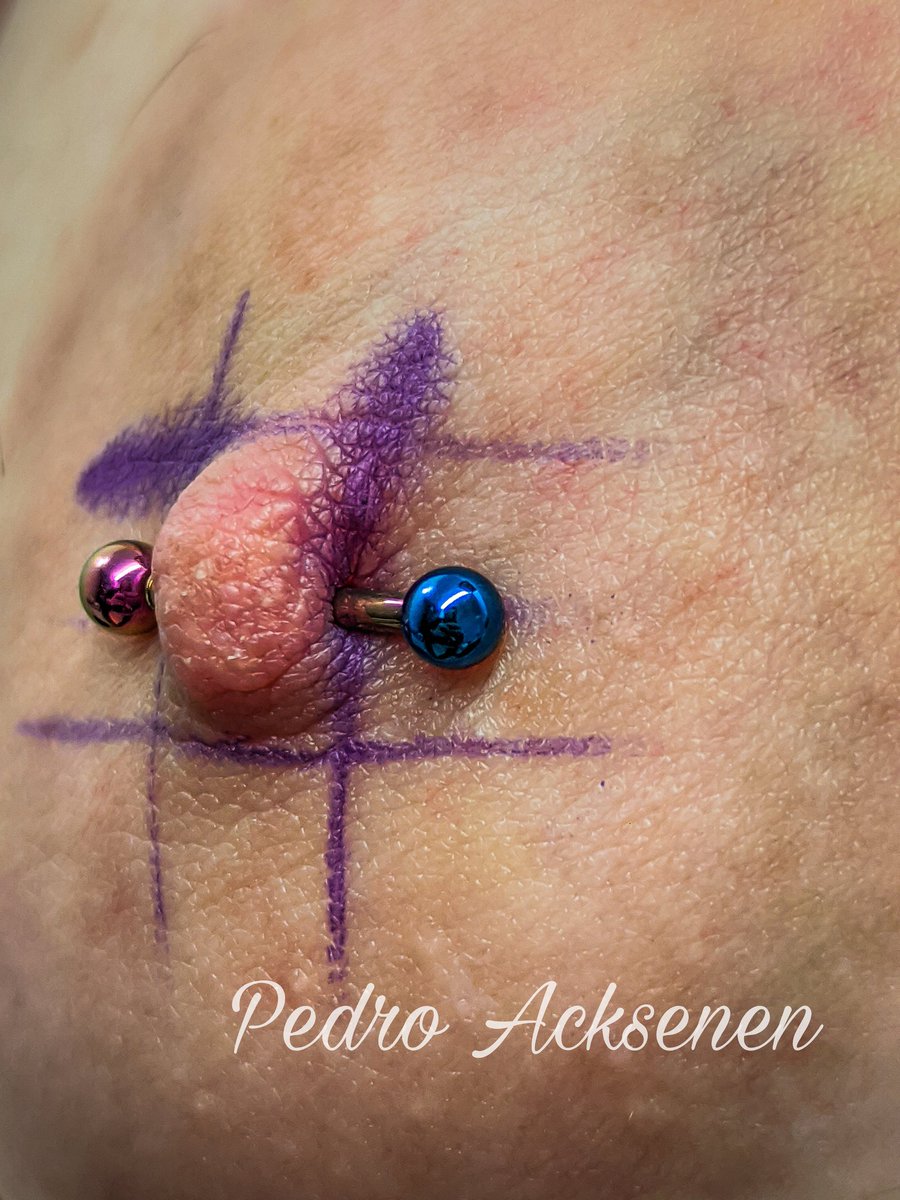 Pedroacksenen's tweet photo. Nipples Piercing (Piercing no mamilo), Joalheria em titanio grau implante F-136 G23, Anodizado 72v e 30v.

#mamilo #piercing #nipple #nipplepiercing #piercingnomamilo #safepiercing #BODYPIERCING https://t.co/d0Z85nhis6