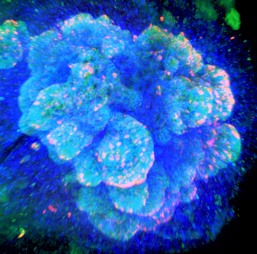 Muneralab's tweet photo. Enteroendocrine cell enriched (CHGA in Red), human pluripotent stem cell derived intestinal organoids #FluorescenceFriday #organoids #humanintestinalorganoids #microscopy #cellbiology #sciart #bioart https://t.co/JJIR3VGy1U