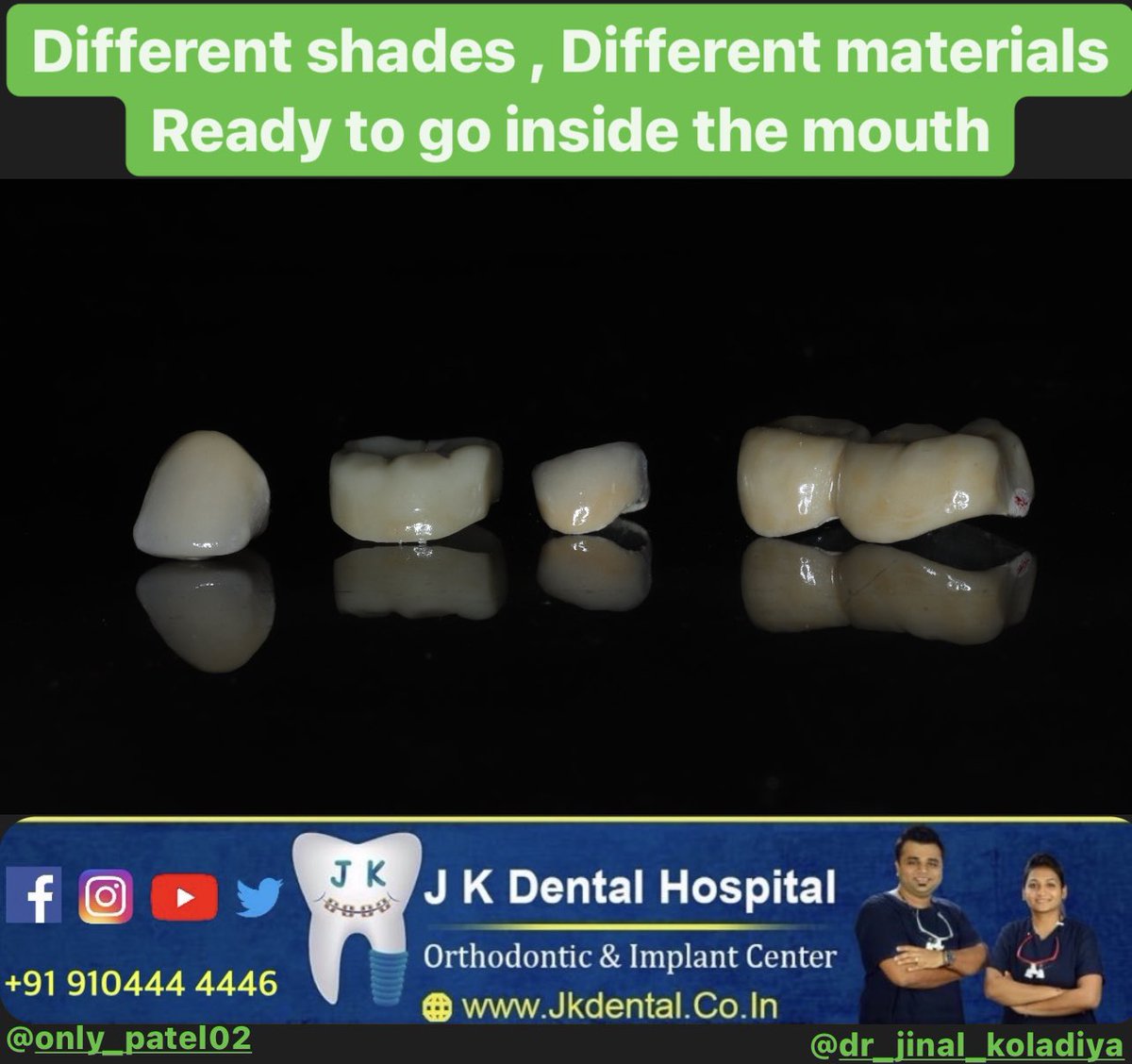 JKDENTALORTHO's tweet image. Zirconia crowns are ready to go inside the mouth at @JKDENTALORTHO , Ahmedabad.

Visit us for your one step dental solution.

#dentist #orthodontist #ahmedabad #braces #aligner #covid #vaccine #trending #zirconia