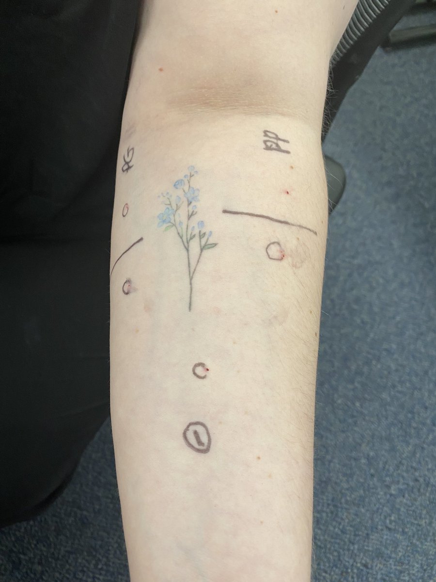 Practice makes perfect! 

Our ID Team hosted a training session yesterday on proper Penicillin Skin Testing technique for the evaluation of patients with suspected penicillin allergies! They were also able to debunk one of our ID PGY2s penicillin allergy.