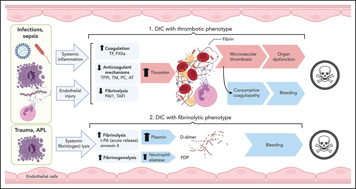 BloodPortfolio's tweet photo. Disseminated intravascular coagulation and its immune mechanisms https://t.co/0qPAHleJ0A https://t.co/TiwZtrTb32