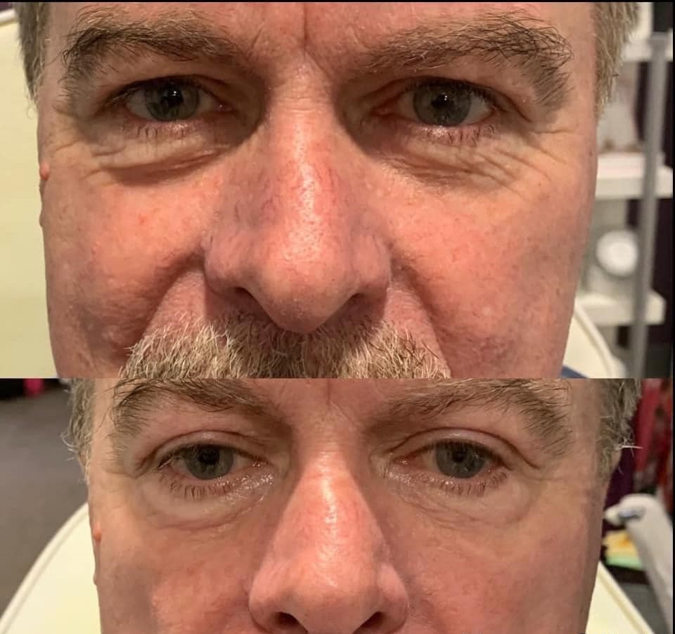 EVALASERTECH's tweet image. The voice from clients is the best compliment, thanks. 
Always be grateful, and work harder to offer more professional products and service. 
#hifu #hifu7D #facelifting #skintightening #ultrasound #bodyshaping #cellulitereduction #wrinkleremoval #necklineremoval #spaowner