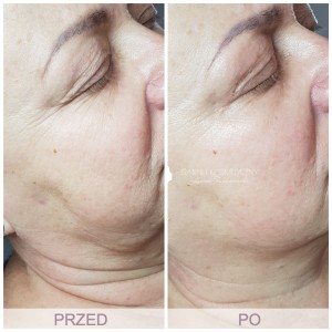 EVALASERTECH's tweet image. The voice from clients is the best compliment, thanks. 
Always be grateful, and work harder to offer more professional products and service. 
#hifu #hifu7D #facelifting #skintightening #ultrasound #bodyshaping #cellulitereduction #wrinkleremoval #necklineremoval #spaowner