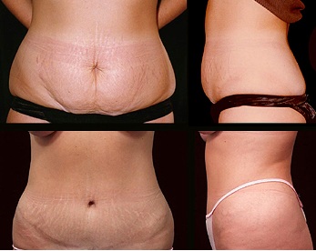 omarjackson's tweet photo. Affordable Cosmetic Surgery Coconut Creek Florida Cosmetic surgeries intend to change or deal with the cosmetic defects on an individual's face or physique. Though there are some plastic surgery procedures that have health care conveniences connected also, many of them address https://t.co/5uixO4bc7x