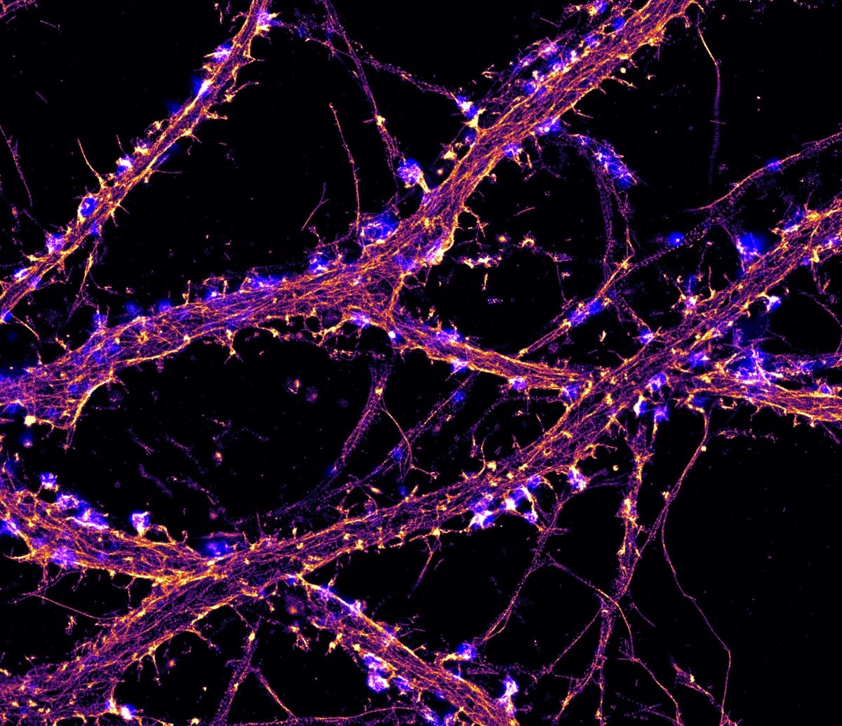 chrost_hugo's tweet photo. Hippocampal neuron labeled for actin (orange) imaged  by STORM and synapsin (blue) imaged by TIRF.  

#neuroscience #NeuroTwitter #Science #Bioinformatics #Biology 

Credit:  Christophe  Leterrier https://t.co/5qmwdJaqve