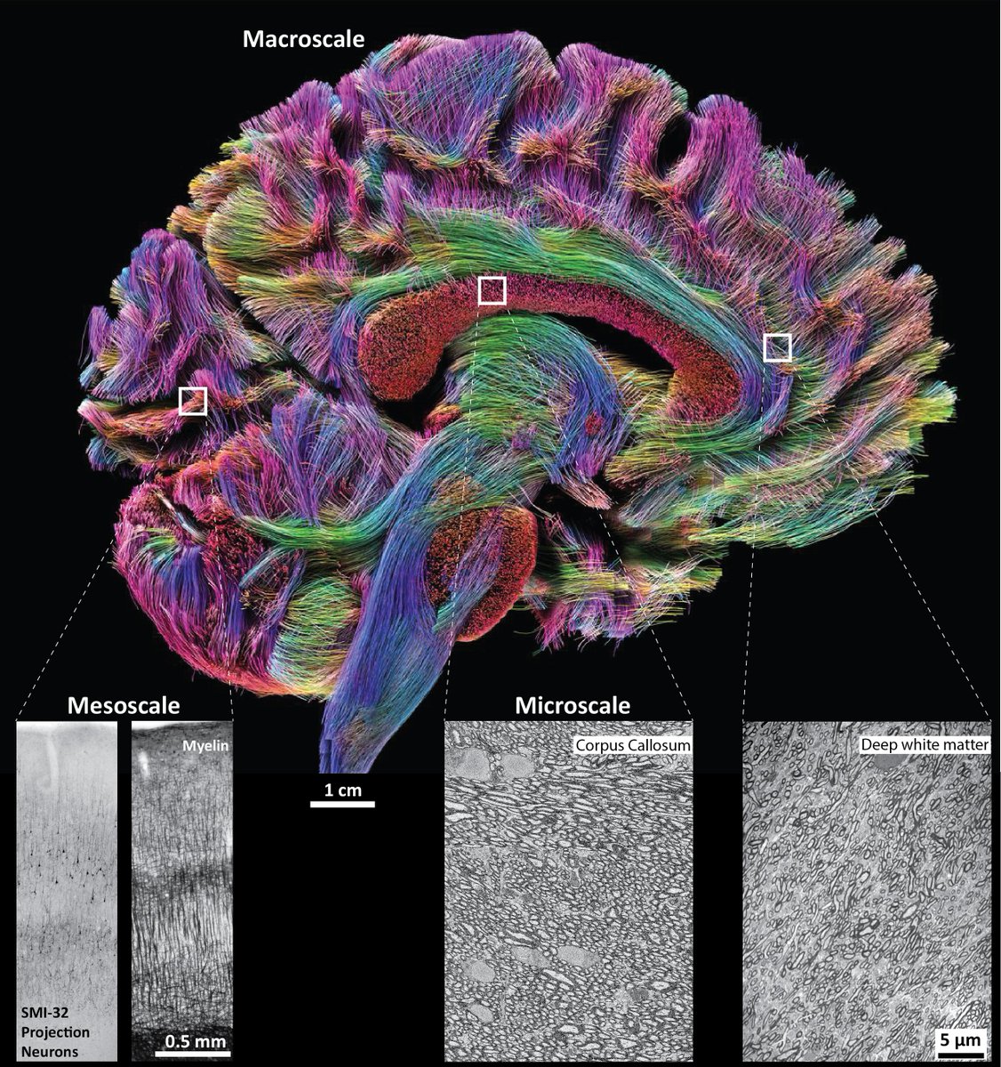 Basilis Zikopoulos (@b_zikopoulos) on Twitter photo #PLOSBiology: The highways and byways of the brain dx.plos.org/10.1371/journa… #PLOSBiology: The highways and byways of the brain dx.plos.org/10.1371/journa…