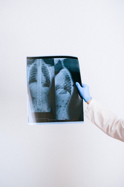 NowAwareDx's tweet photo. #COPD an irreversible, chronic and progressive disease, impacts approximately 15% of the adult population in the U.S. While millions of people have already been diagnosed with COPD there are millions more that have yet to be diagnosed due to a lack of an objective diagnostic test https://t.co/gANWKHDZ4C