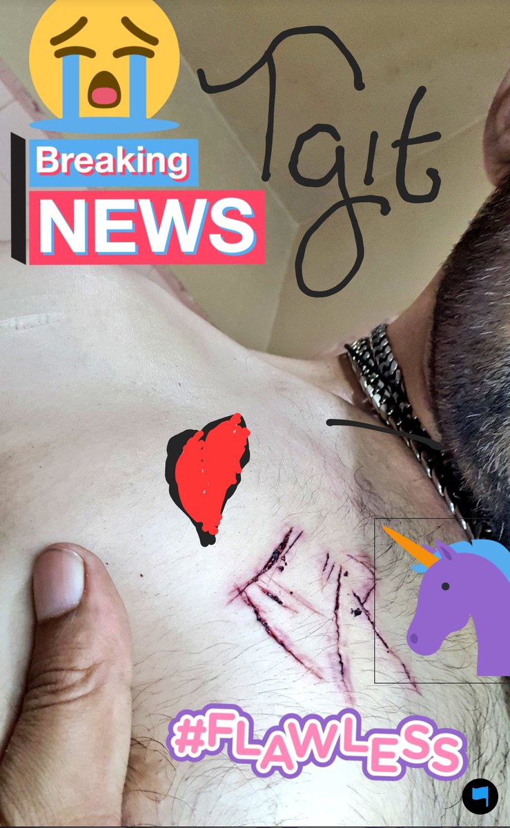 Cryptaled's tweet photo. @Helloimmorgan My dear Morgan I'm not scared of ashleybor any 1 any more just that cared if I can have such important temple worshiping sum other can. Haves to but who was that provider at first thas the main puzzle can fight for me bo0 n legally If u rmmbrs,food poisoned now did this cosa ER. https://t.co/dZSDpwITU4