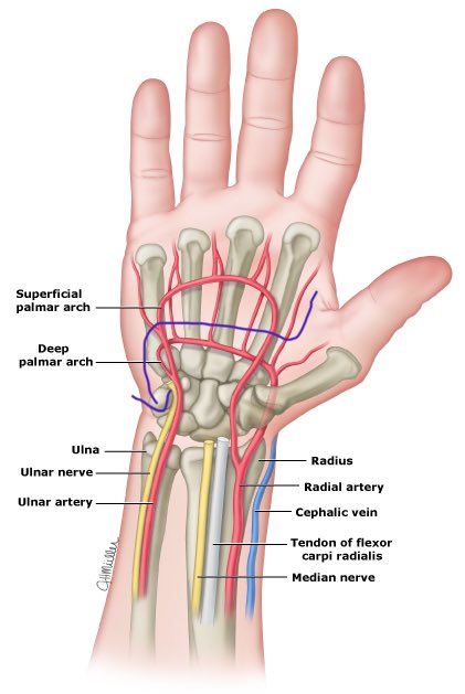 GhChoo's tweet photo. @w_jyg @RadialFirstBot @radialfirst @mate2k @PCRonline @BotPci @marcosdanilloMD @drgianma @kaschenke @SVRaoMD @ferdikiem @Tesslagra @nolanjimradial @visishs @dimitri_zappi Your wire probably went via deep palmar arch to the ulnar artery. Nice sharing. Thanks https://t.co/OcKm0hSXdL