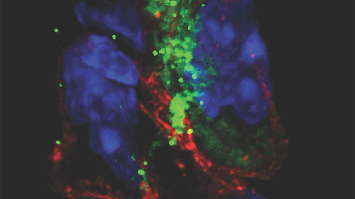 WeillCornell's tweet photo. New study links COVID-19 infection to changes in the heart’s rhythmic beat that may explain heart arrhythmias in some COVID patients, says Dr. Shuibing Chen (@ChenShuibing) of @WCMResearch and investigators from #WCM, @nyphospital and @nyugrossman: https://t.co/khCa2Wa33s https://t.co/Q6OWYvijjc