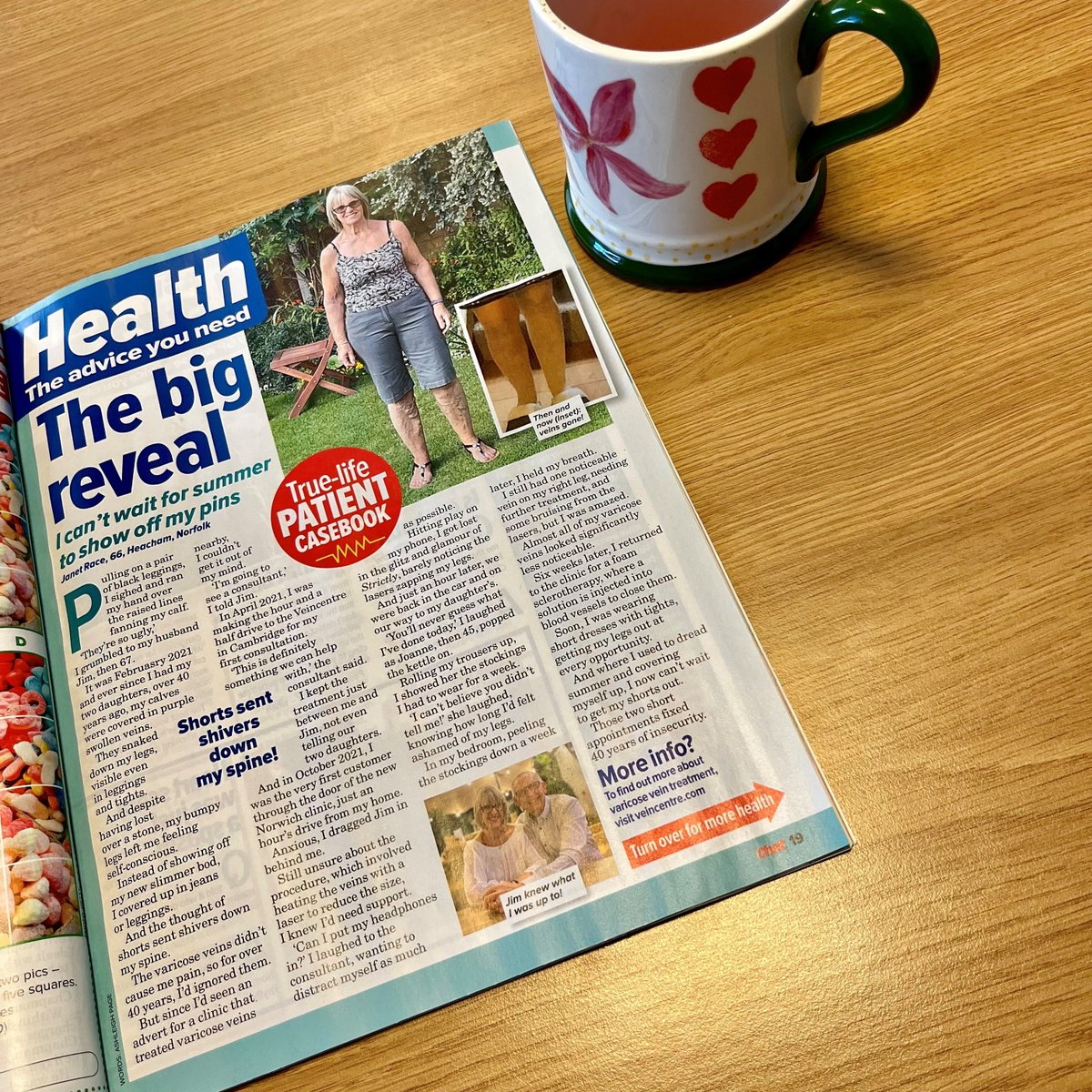 veincentreltd's tweet photo. Happy Friday! We are in Chat Magazine this week. The amazing Janet shared her story and how "two short appointments fixed 40 years of insecurity".
If you want to learn more, contact our patient advisers on 01782 753960.
#chatmagazine #casestudy #varicoseveins https://t.co/BL2CElaAHt