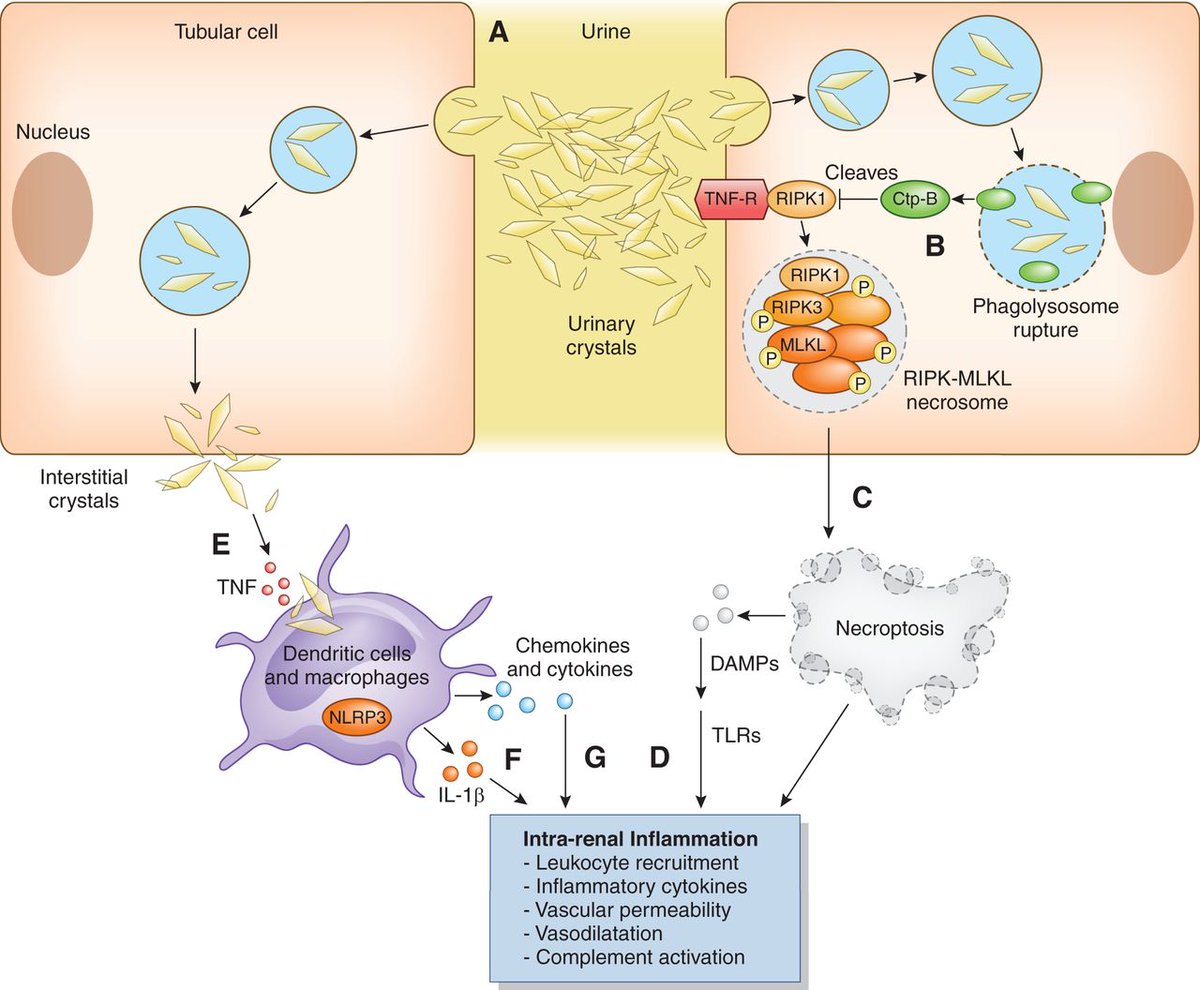 asnpublications's tweet photo. Medications are a common cause of AKI especially for patients admitted to hospital wards and the intensive care unit. This Critical Care Nephrology and Acute Kidney Injury article discusses drug-related kidney injury in tubulointerstitial injury https://t.co/Ip9hY9kGB6 https://t.co/Dr17ctYa22