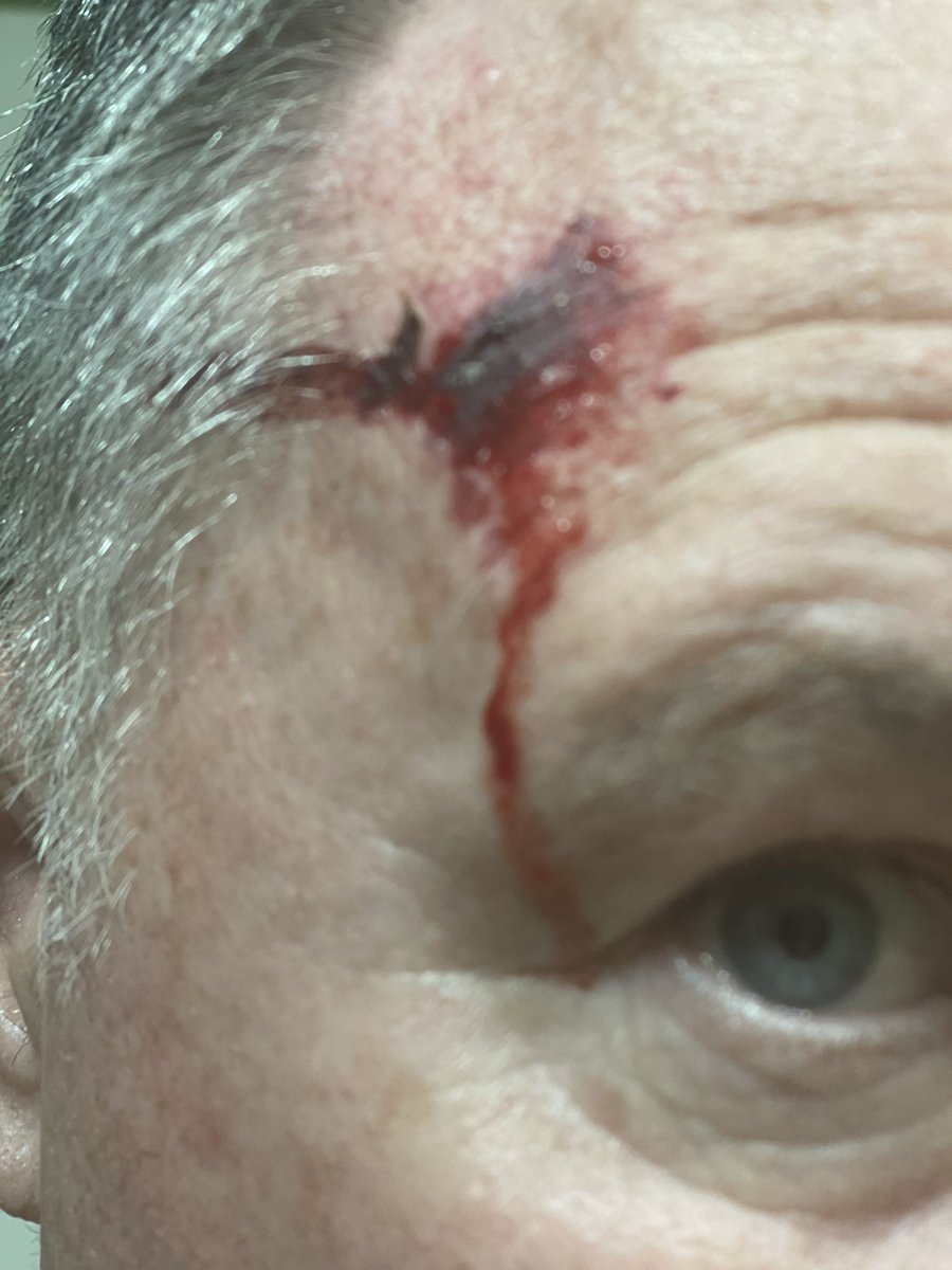 Larry  BiFF  Balko tweet media