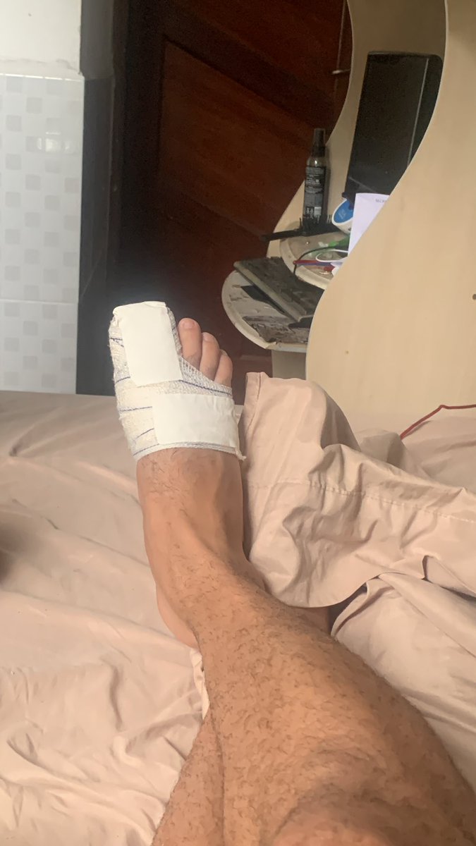 AbreuRhamon's tweet photo. Lhes apresento meu dedo quebrado ! https://t.co/mKNuyB6d3p