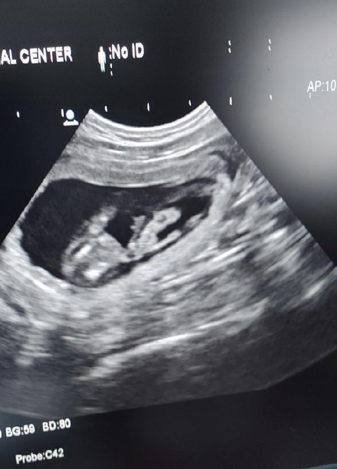 Newest addition to the Bake family coming in 2022! Can’t wait to meet you 🥰🥰