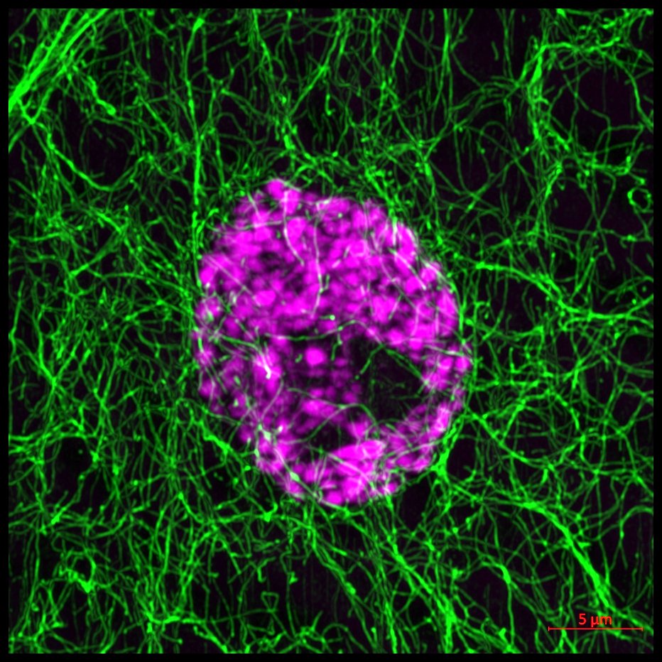 Bret Judson (@judsonlab) on Twitter photo For your #FluorescenceFriday consideration here is a <a href="/zeiss_micro/">ZEISS Microscopy</a> Airyscan image of microtubules and a nucleus in Drosophila muscle. Never get tired of imaging these. With <a href="/folker_lab/">Eric Folker</a> and <a href="/BostonCollege/">Boston College</a> For your #FluorescenceFriday consideration here is a <a href="/zeiss_micro/">ZEISS Microscopy</a> Airyscan image of microtubules and a nucleus in Drosophila muscle. Never get tired of imaging these. With <a href="/folker_lab/">Eric Folker</a> and <a href="/BostonCollege/">Boston College</a>
