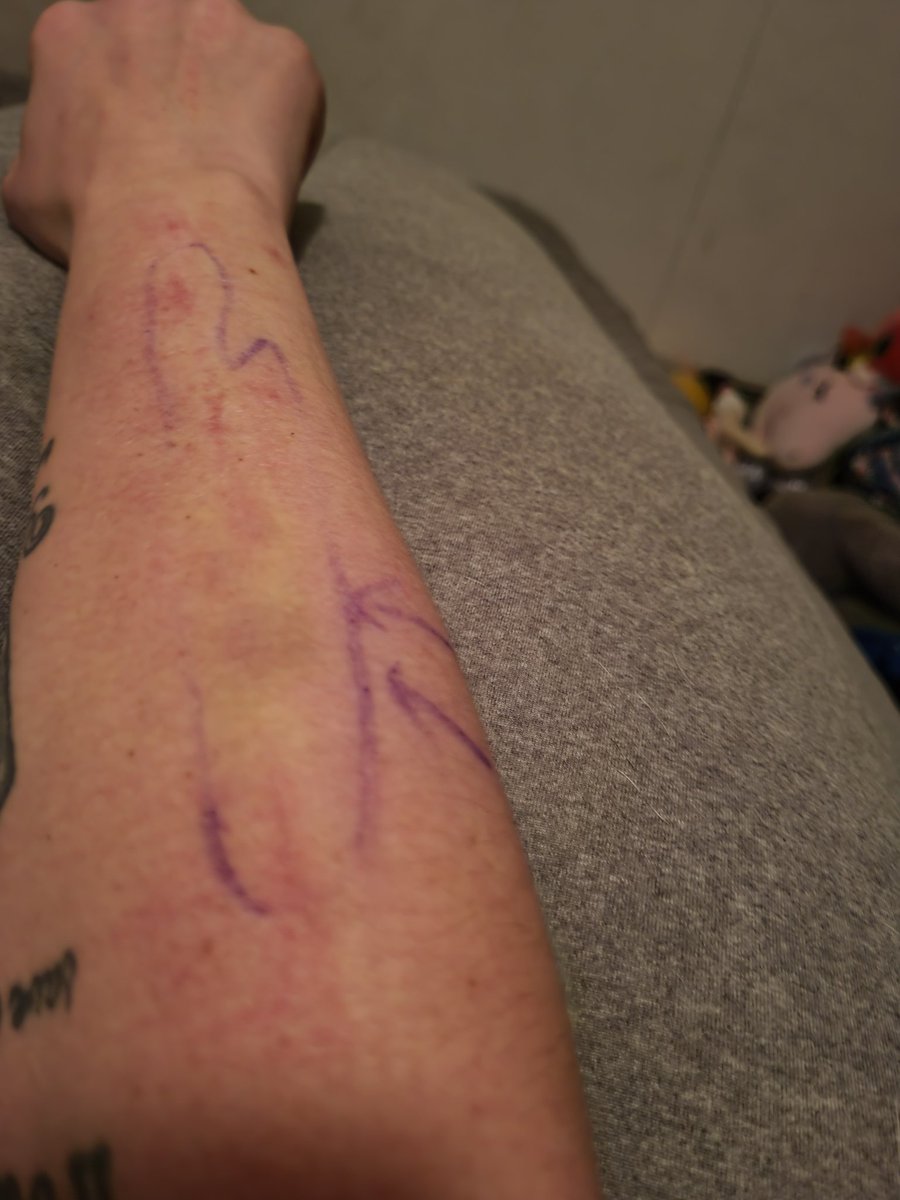 I was planning on streaming since I'm on long weekend with 7days off. 

unfortunately I was electrocuted &amp; took what they claim is 250 volts to the arm &amp; got burnt from my fingers to my elbow🤦🏽‍♀️ the gloves I wore saved my life ultimately