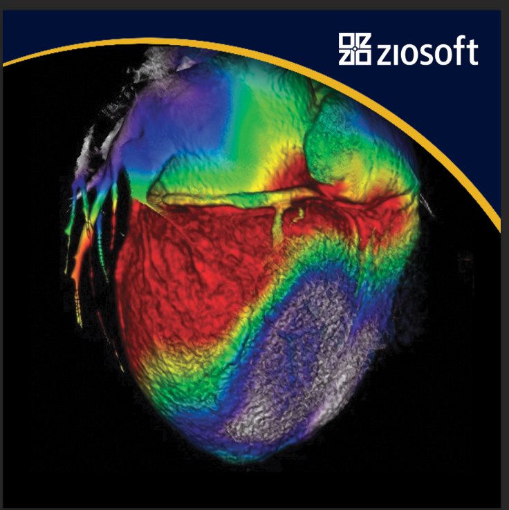 ziosoft's tweet photo. Visit Ziosoft at ACC Booth #2006 and let us show you a wide variety of 3D/4D cardiac visualization on our unique PhyZiodynamics platform designed to support excellence in patient care. #ACC22 , #Cardiology #cardiovascular #Cardio #radiology https://t.co/mssqg6PG65