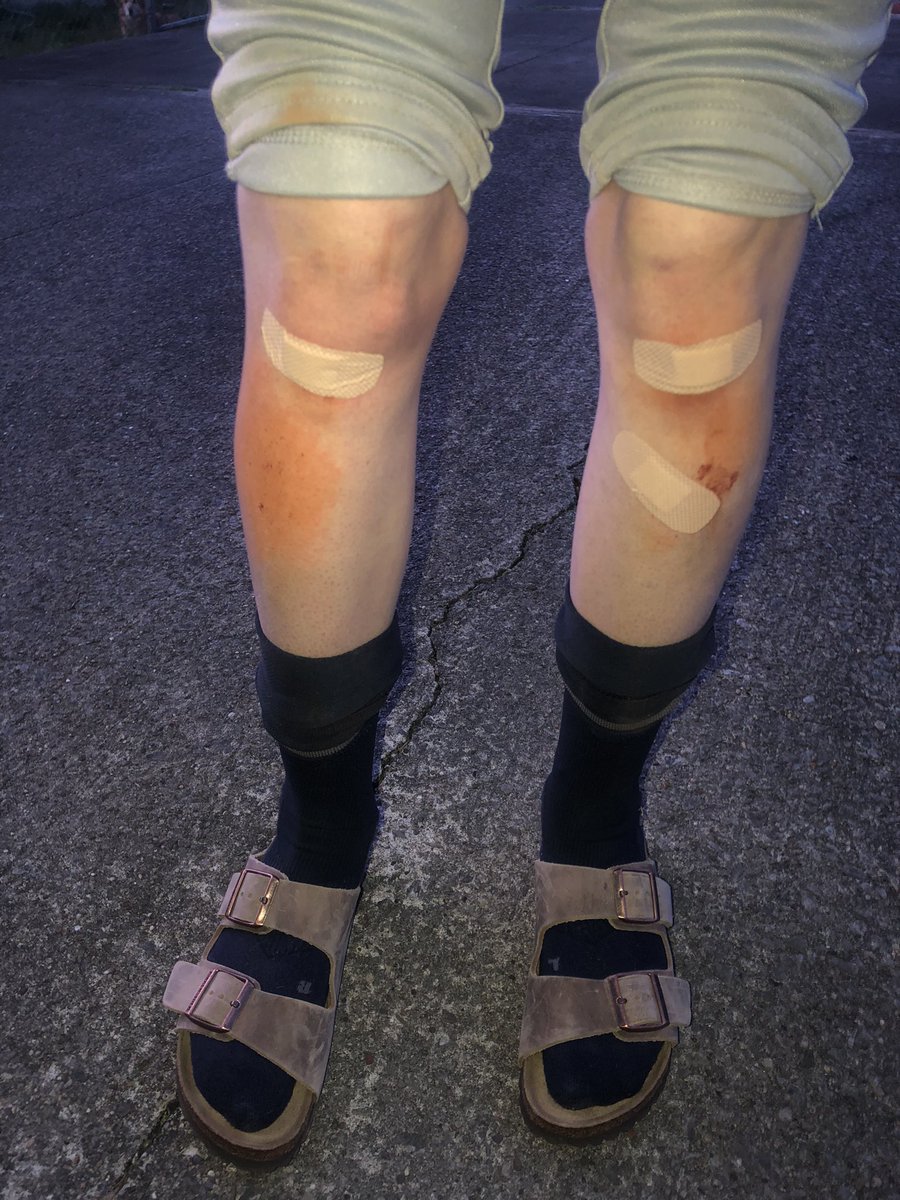 BrianSimpsonKY's tweet photo. We got the win in a 3 hour slugfest!  @Riley7WA came home “Banged up, Bruised, Battered, and Bloody in her 1st ever game playing Shortstop tonight! #Team4B @WhitefieldAcad1 #whitefieldAcademySB https://t.co/XYoHH0OETL