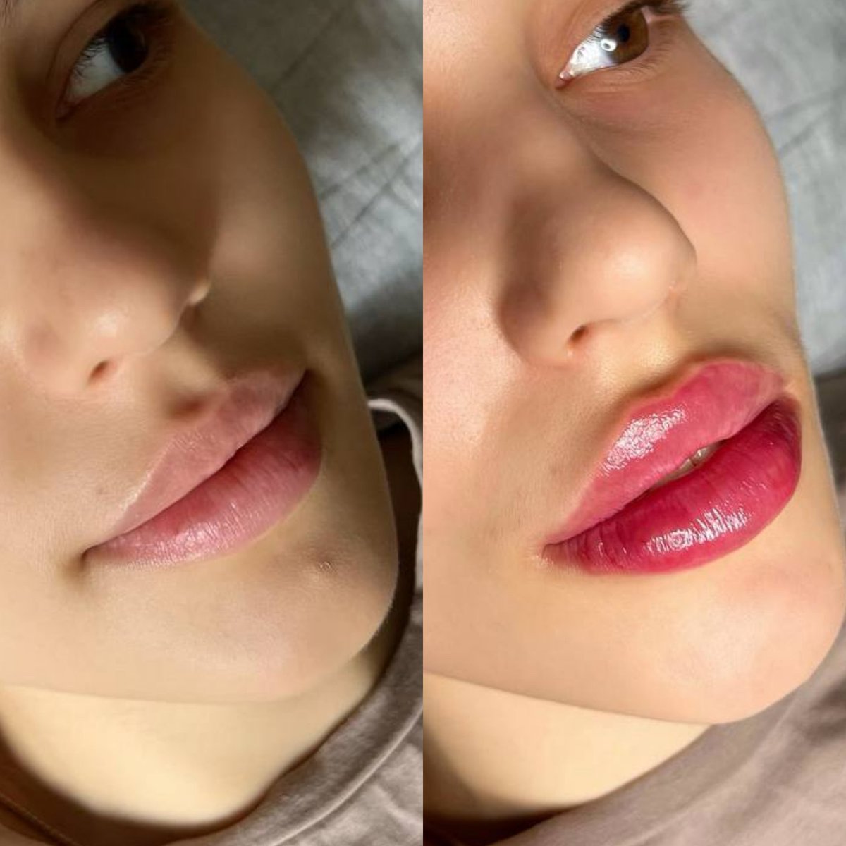 Fes4enko's tweet photo. Когда девушке хотелось более чувственные 👄 Пожелания выполнены🥰

#увеличениегубсамара #весна #самаракосметолог #косметолог #губысамара https://t.co/RAbQgFBdgf