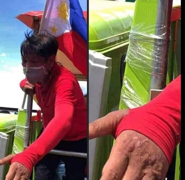 sejoalzir's tweet photo. Bahala na kayong magbasa at maghusga. Nakakapagod na ang pagsusulat. Dapat trabaho ito ng mga doktor na bihasa sa drug addiction o chronic drug abuse. https://t.co/ERjYNVnBkR