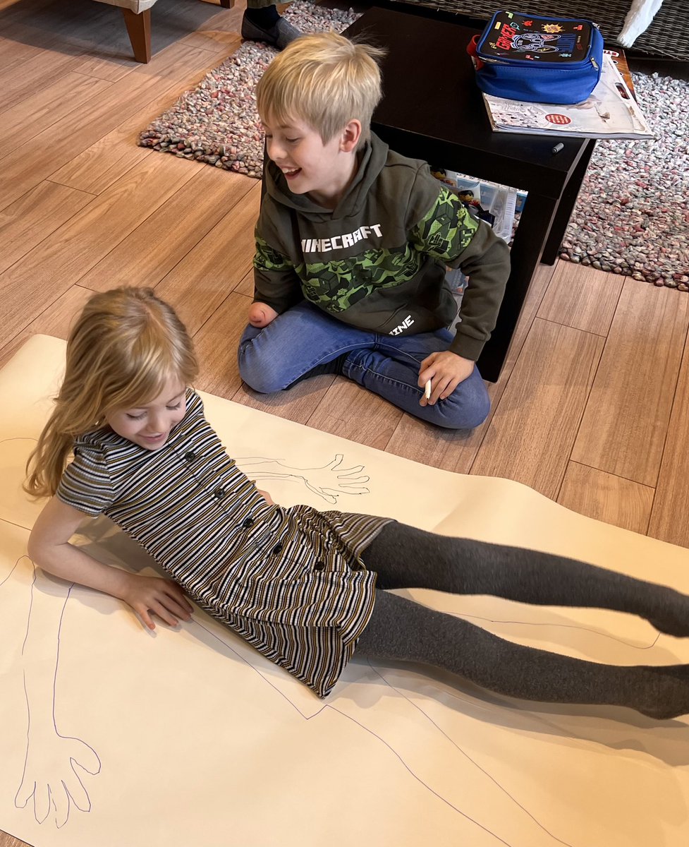 LBofoundation's tweet photo. #limbdifferenceawareness #DayInTheLife #tommyd and LJ playing together, they love cutting and sticking @KoalaaCommunity @IAMPOSSIBLEFdn @TeamUnLimbited @LimbPower https://t.co/59jHdJ2xeI