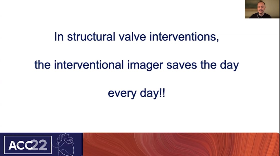 JACC Journals (@jaccjournals) on Twitter photo In structural valve interventions, good quality interventions cannot be done without good quality #cvImaging provided by a dedicated interventional imager physician - <a href="/m_taramasso/">Maurizio taramasso</a>
#CardioTwitter #ACC22 #JACCCaseReports #TAVI In structural valve interventions, good quality interventions cannot be done without good quality #cvImaging provided by a dedicated interventional imager physician - <a href="/m_taramasso/">Maurizio taramasso</a>
#CardioTwitter #ACC22 #JACCCaseReports #TAVI